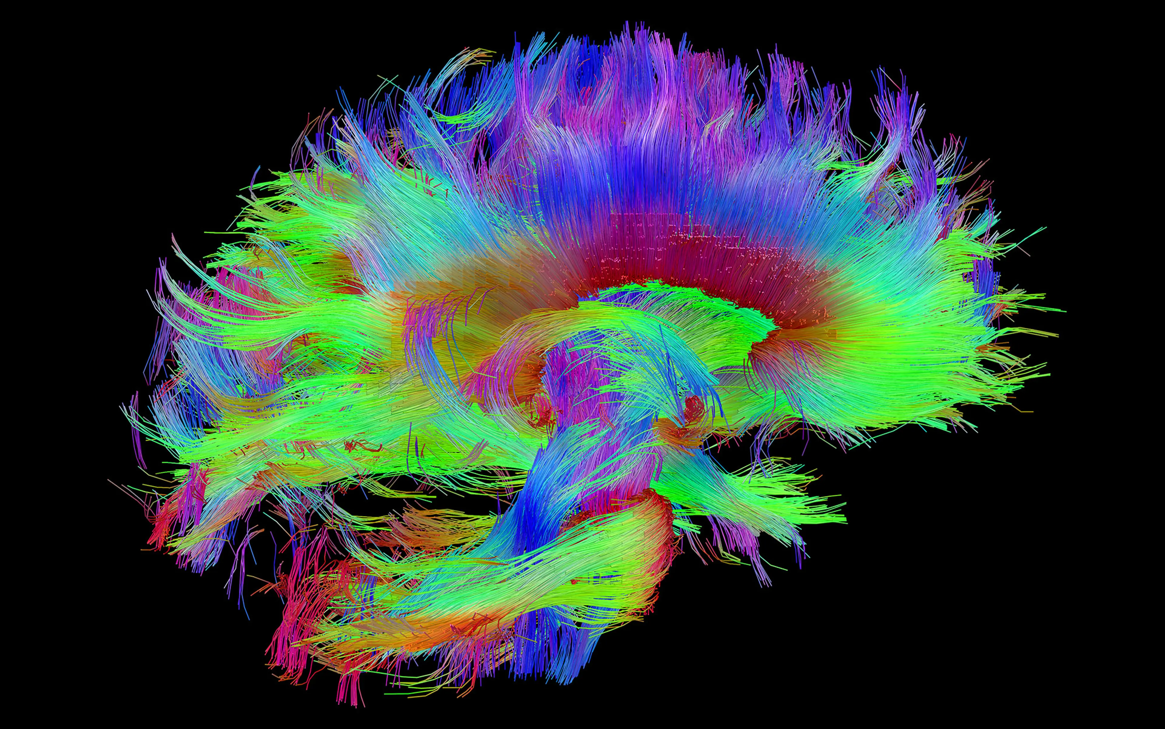 DTI brain fiber tracts